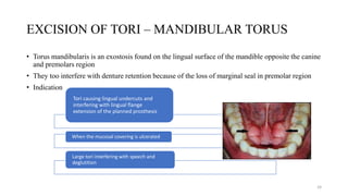 EXCISION OF TORI – MANDIBULAR TORUS
• Torus mandibularis is an exostosis found on the lingual surface of the mandible opposite the canine
and premolars region
• They too interfere with denture retention because of the loss of marginal seal in premolar region
• Indication
Tori causing lingual undercuts and
interfering with lingual flange
extension of the planned prosthesis
When the mucosal covering is ulcerated
Large tori interfering with speech and
deglutition
24
 