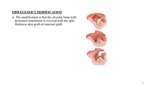 OBWEGESER’S MODIFICATION
 The modification is that the alveolar bone with
periosteal attachment is covered with the split
thickness skin graft or mucosal graft
41
 