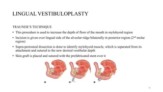 LINGUAL VESTIBULOPLASTY
TRAUNER’S TECHNIQUE
• This procedure is used to increase the depth of floor of the mouth in mylohyoid region
• Incision is given over lingual side of the alveolar ridge bilaterally in posterior region (2nd molar
region)
• Supra-periosteal dissection is done to identify mylohyoid muscle, which is separated from its
attachment and sutured to the new desired vestibular depth
• Skin graft is placed and sutured with the prefabricated stent over it
43
 