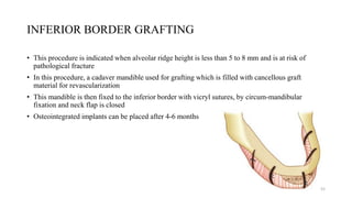 INFERIOR BORDER GRAFTING
• This procedure is indicated when alveolar ridge height is less than 5 to 8 mm and is at risk of
pathological fracture
• In this procedure, a cadaver mandible used for grafting which is filled with cancellous graft
material for revascularization
• This mandible is then fixed to the inferior border with vicryl sutures, by circum-mandibular
fixation and neck flap is closed
• Osteointegrated implants can be placed after 4-6 months
52
 