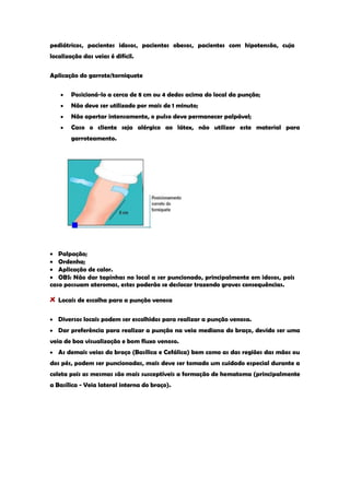 pediátricos, pacientes idosos, pacientes obesos, pacientes com hipotensão, cuja localização das veias é difícil. 
Aplicação do garrote/torniquete Posicioná-lo a cerca de 8 cm ou 4 dedos acima do local da punção; Não deve ser utilizado por mais de 1 minuto; Não apertar intensamente, o pulso deve permanecer palpável; Caso o cliente seja alérgico ao látex, não utilizar este material para garroteamento. 
Palpação; Ordenha; Aplicação de calor. OBS: Não dar tapinhas no local a ser puncionado, principalmente em idosos, pois caso possuam ateromas, estes poderão se deslocar trazendo graves consequências. Locais de escolha para a punção venosa Diversos locais podem ser escolhidos para realizar a punção venosa. Dar preferência para realizar a punção na veia mediana do braço, devido ser uma veia de boa visualização e bom fluxo venoso. As demais veias do braço (Basílica e Cefálica) bem como as das regiões das mãos ou dos pés, podem ser puncionadas, mais deve ser tomado um cuidado especial durante a coleta pois as mesmas são mais susceptíveis a formação de hematoma (principalmente a Basílica - Veia lateral interna do braço).  