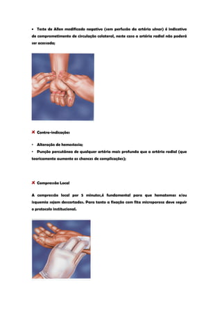 Teste de Allen modificado negativo (sem perfusão da artéria ulnar) é indicativo de comprometimento de circulação colateral, neste caso a artéria radial não poderá ser acessada; 
Contra-indicações 
• Alteração de hemostasia; 
• Punção percutânea de qualquer artéria mais profunda que a artéria radial (que teoricamente aumente as chances de complicações); 
Compressão Local 
A compressão local por 5 minutos,é fundamental para que hematomas e/ou isquemia sejam descartados. Para tanto a fixação com fita microporosa deve seguir o protocolo institucional. 
 