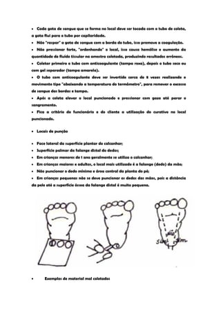 Cada gota de sangue que se forma no local deve ser tocada com o tubo de coleta, a gota flui para o tubo por capilaridade. Não "raspar" a gota de sangue com a borda do tubo, isso promove a coagulação. Não pressionar forte, "ordenhando" o local, isso causa hemólise e aumento da quantidade de fluído tissular na amostra coletada, produzindo resultados errôneos. Coletar primeiro o tubo com anticoagulante (tampa roxa), depois o tubo seco ou com gel separador (tampa amarela). O tubo com anticoagulante deve ser invertido cerca de 8 vezes realizando o movimento tipo "abaixando a temperatura do termômetro", para remover o excesso de sangue das bordas e tampa. Após a coleta elevar o local puncionado e pressionar com gaze até parar o sangramento. Fica a critério do funcionário e do cliente a utilização do curativo no local puncionado. Locais de punção Face lateral da superfície plantar do calcanhar; Superfície palmar da falange distal do dedos; Em crianças menores de 1 ano geralmente se utiliza o calcanhar; Em crianças maiores e adultos, o local mais utilizado é a falange (dedo) da mão; Não puncionar o dedo mínimo e área central da planta do pé; Em crianças pequenas não se deve puncionar os dedos das mãos, pois a distância da pele até a superfície óssea da falange distal é muito pequena. Exemplos de material mal coletados  