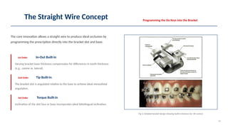 Leftwise Wire Preadjusted Edgewise Technique. Straight wire | PPTX