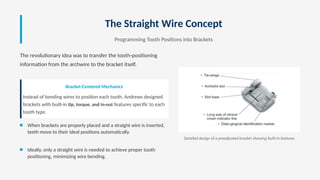 Leftwise Wire Preadjusted Edgewise Technique: First Generation Brackets - Andrew's ...