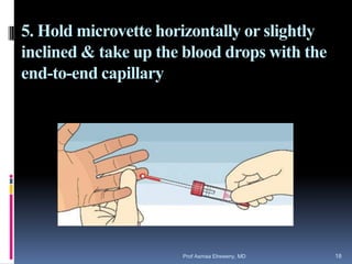5. Hold microvette horizontally or slightly
inclined & take up the blood drops with the
end-to-end capillary
Prof Asmaa Elreweny, MD 18
 