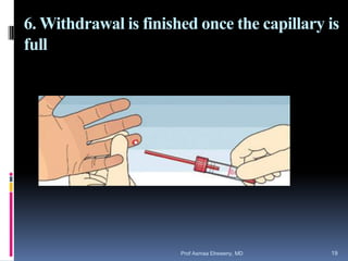 6. Withdrawal is finished once the capillary is
full
Prof Asmaa Elreweny, MD 19
 
