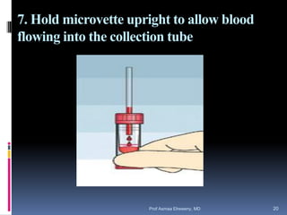 7. Hold microvette upright to allow blood
flowing into the collection tube
Prof Asmaa Elreweny, MD 20
 
