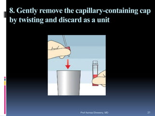 8. Gently remove the capillary-containing cap
by twisting and discard as a unit
Prof Asmaa Elreweny, MD 21
 