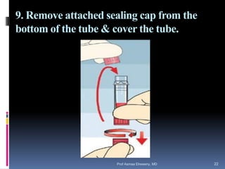 9. Remove attached sealing cap from the
bottom of the tube & cover the tube.
Prof Asmaa Elreweny, MD 22
 