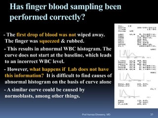 Has finger blood sampling been
performed correctly?
- The first drop of blood was not wiped away.
The finger was squeezed & rubbed.
- This results in abnormal WBC histogram. The
curve does not start at the baseline, which leads
to an incorrect WBC level.
- However, what happens if Lab does not have
this information? It is difficult to find causes of
abnormal histogram on the basis of curve alone
- A similar curve could be caused by
normoblasts, among other things.
Prof Asmaa Elreweny, MD 31
 
