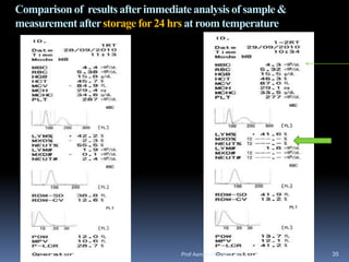 Comparison of results afterimmediate analysis of sample &
measurement afterstorage for24 hrs at room temperature
Prof Asmaa Elreweny, MD 35
 
