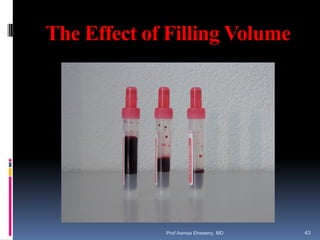 The Effect of Filling Volume
Prof Asmaa Elreweny, MD 43
 