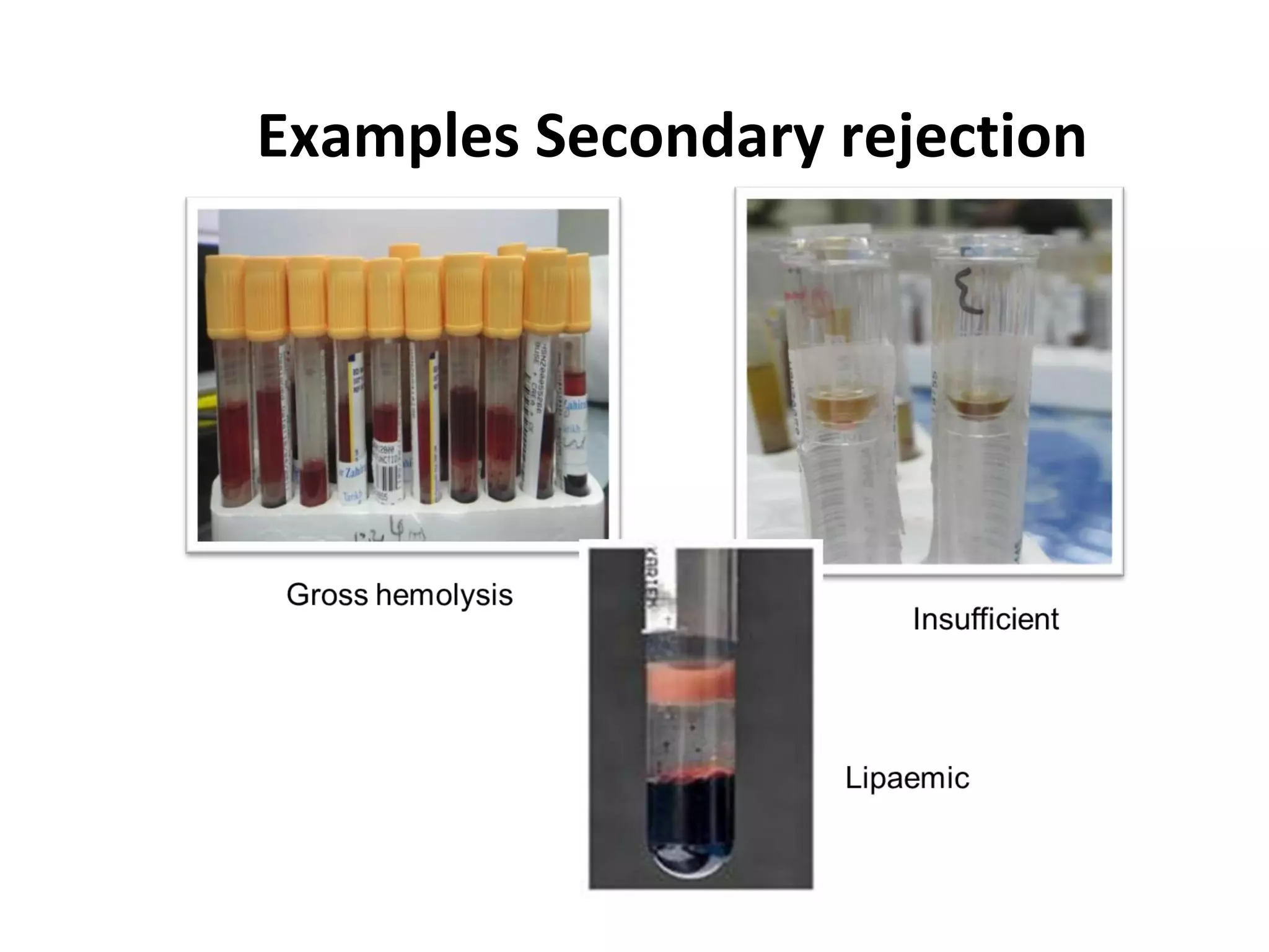 Examples Secondary rejection
 
