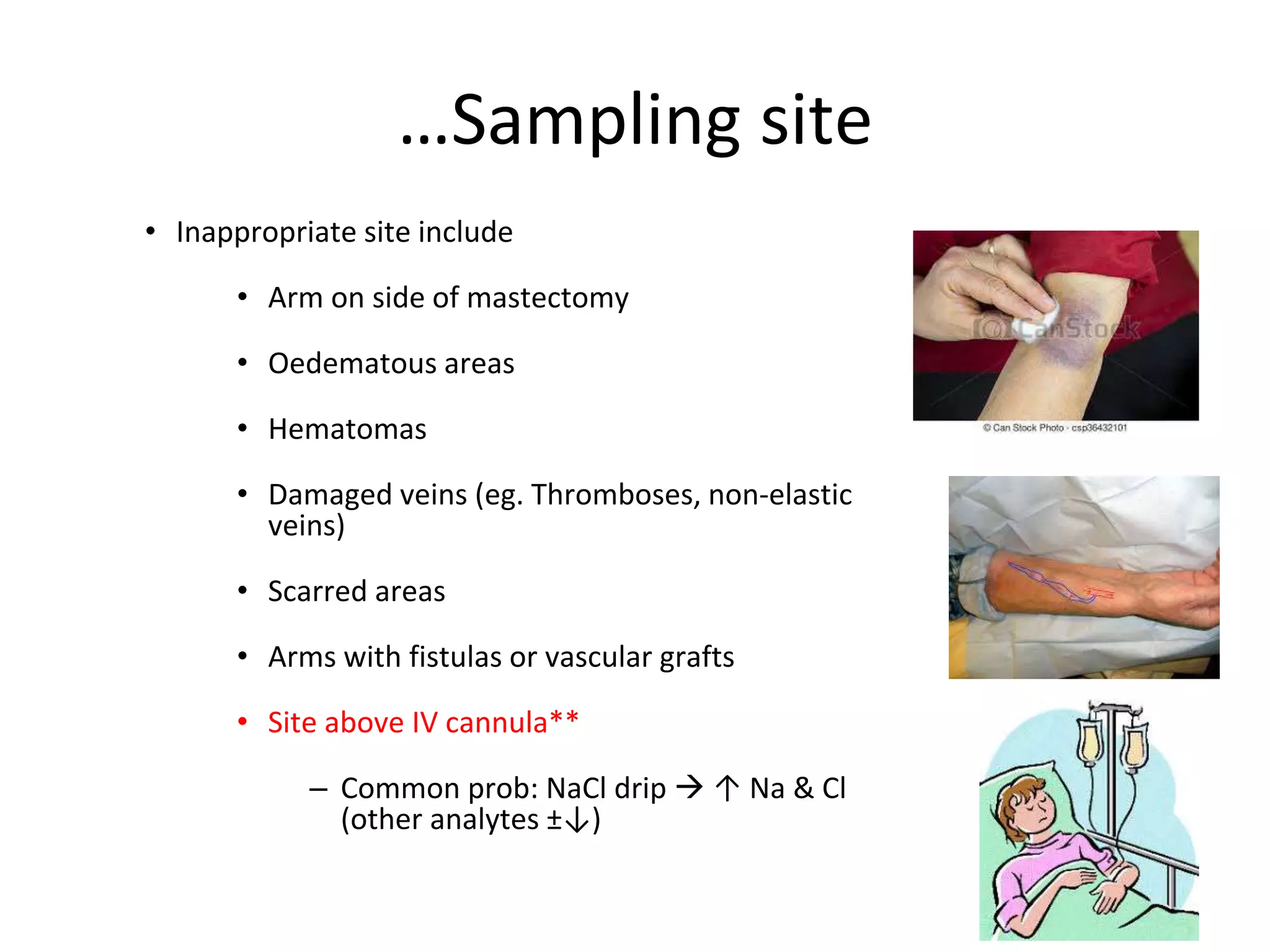 • Inappropriate site include
• Arm on side of mastectomy
• Oedematous areas
• Hematomas
• Damaged veins (eg. Thromboses, non-elastic
veins)
• Scarred areas
• Arms with fistulas or vascular grafts
• Site above IV cannula**
– Common prob: NaCl drip  ↑ Na & Cl
(other analytes ±↓)
…Sampling site
 