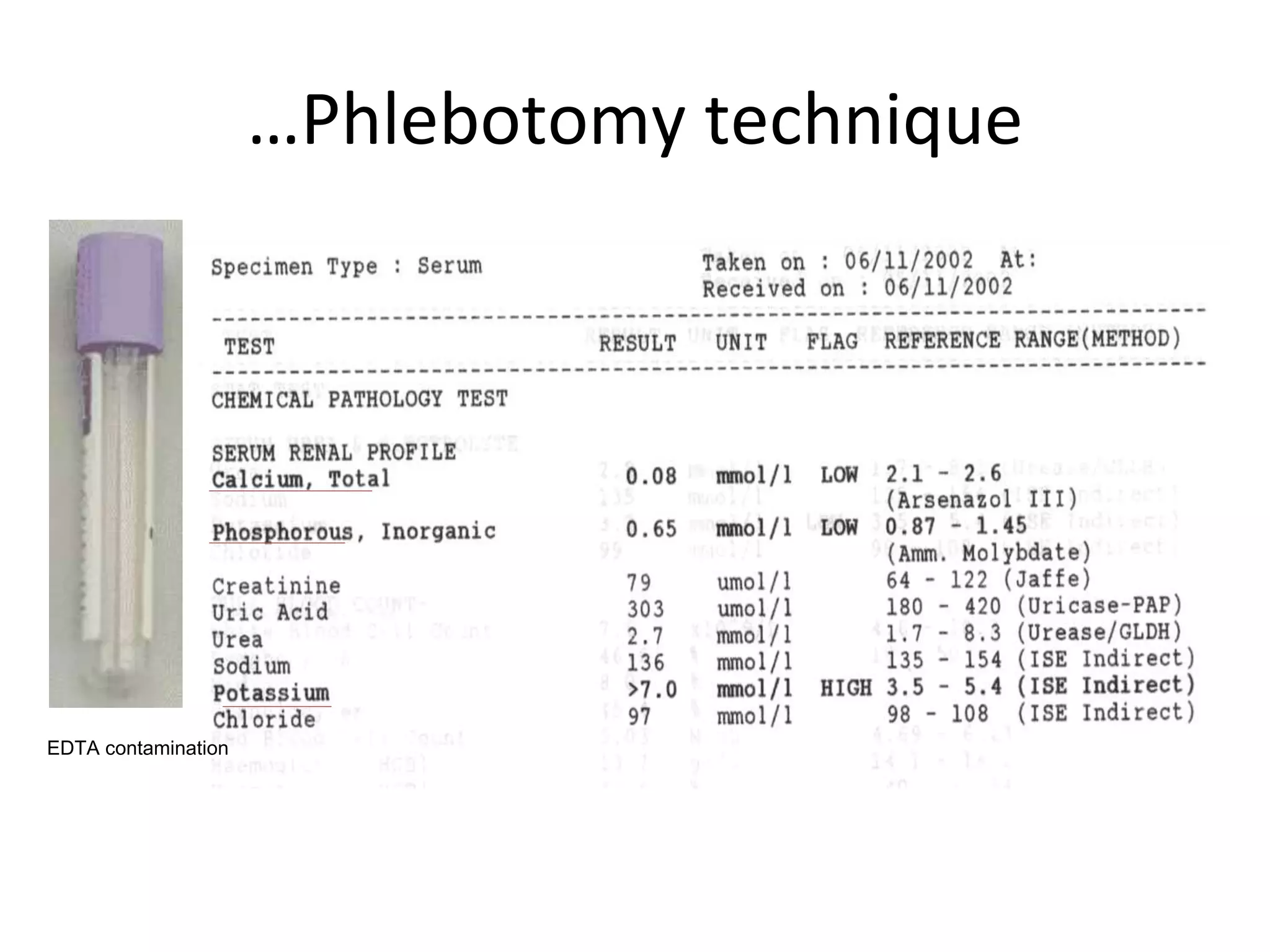 …Phlebotomy technique
EDTA contamination
 