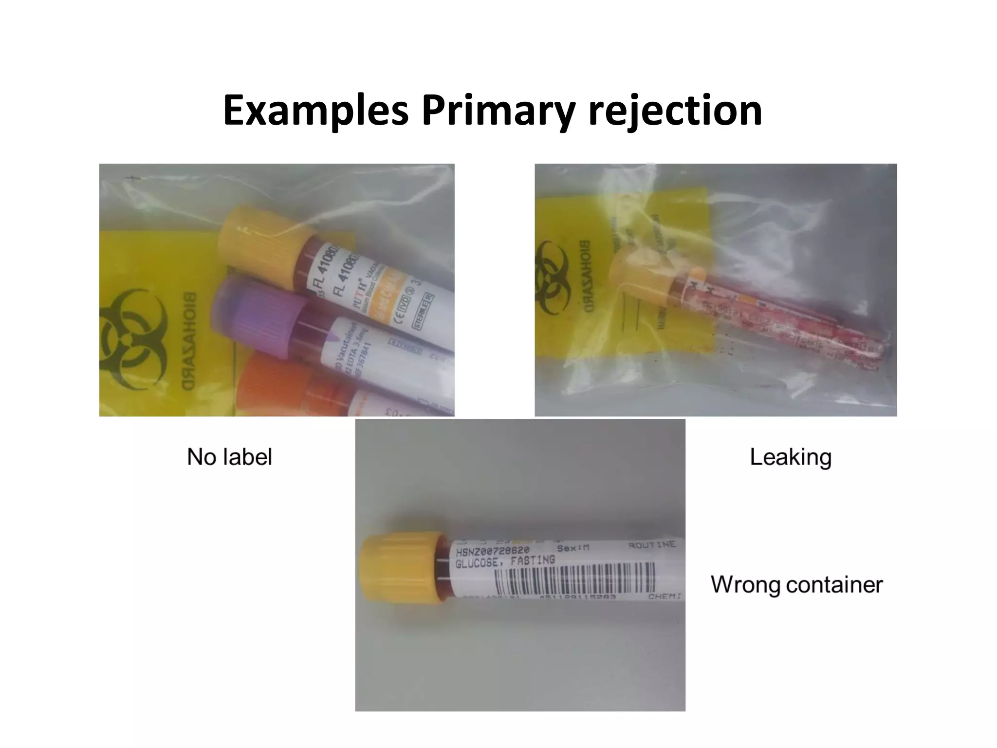 Examples Primary rejection
 