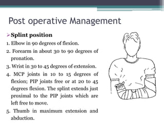 Post operative Management
Splint position
1. Elbow in 90 degrees of flexion.
2. Forearm in about 30 to 90 degrees of
pronation.
3. Wrist in 30 to 45 degrees of extension.
4. MCP joints in 10 to 15 degrees of
flexion; PIP joints free or at 20 to 45
degrees flexion. The splint extends just
proximal to the PIP joints which are
left free to move.
5. Thumb in maximum extension and
abduction.
 