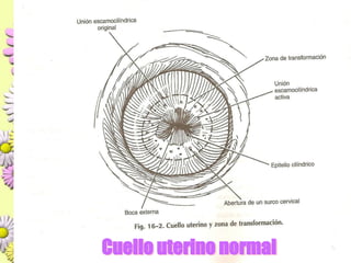 Cuello uterino normal