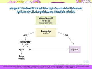 Wright TC, Moscarelli RD, Dole P, Ellerbrock TV, Chiasson MA, Vandevanter N.  Clinicalsignificance of mildcytologicatypiaon Papanicolaou smearsfromwomeninfectedwithhumanimmunodeficiency virus. ObstetGynecol. 1996;87:515-519. 