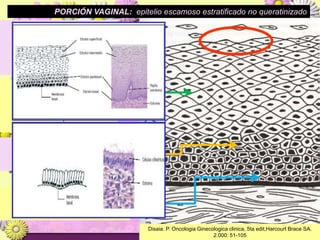 PORCIÓN VAGINAL:  epitelio escamoso estratificado no queratinizadoCapa Superficial: 5 a 8 filas de células aplanadas, núcleos pequeños, citoplasma lleno de glucógenoCapa Intermedia: 4 a 6 filas de células. Con abundante citoplasma y forma poliédricas . GlucogenoCapa Para-basal: 2 a 4 filas de células inmaduras con figuras normalesCapa Basal: una sola fila de células inmaduras, núcleos grandes, citoplasma escaso.Disaia. P. Oncologia Ginecologica clinica, 5ta edit,Harcourt Brace SA. 2.000: 51-105