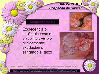 ETIOPATOGENIA< 10% 4 añosLIE-BLIE-AProbabilidad de progresión aproximada 