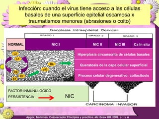 Infección: cuando el virus tiene acceso a las células basales de una superficie epitelial escamosa x traumatismos menores (abrasiones o coito)NORMALNIC INIC IINIC IIICa In situHiperplasia circunscrita de células basalesL2L1Queratosis de la capa celular superficialRbp53Proceso celular degenerativo: coilocitosisE8E7E1FACTOR INMUNULOGICO PERSISTENCIA                               NICApgar, Brotzman. Colposcopia: Principios y practica. Mc Graw Hill. 2002. p 1 y ss