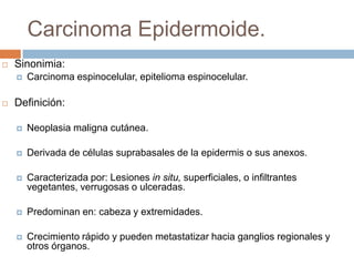 Carcinoma Epidermoide.
   Sinonimia:
       Carcinoma espinocelular, epitelioma espinocelular.

   Definición:

       Neoplasia maligna cutánea.

       Derivada de células suprabasales de la epidermis o sus anexos.

       Caracterizada por: Lesiones in situ, superficiales, o infiltrantes
        vegetantes, verrugosas o ulceradas.

       Predominan en: cabeza y extremidades.

       Crecimiento rápido y pueden metastatizar hacia ganglios regionales y
        otros órganos.
 