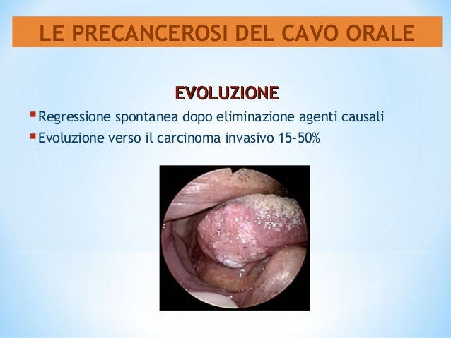 Assistenza psicologica a dipendenza alcolica di Ivanovo