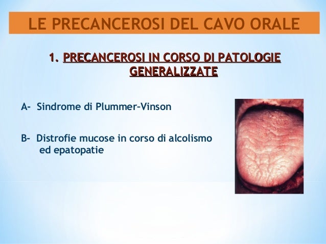Produttore di Colm Spain del prezzo