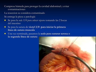 Compresa húmeda para proteger la cavidad abdominal y evitar contaminaciones La reseccion se considera contaminado  Se entrega la pieza a patología Se pasa la  seda 3/0 para colocar reparos  tomando las 2 bocas del intestino Se pasa la sutura de  vicryl 3/0  para iniciar la primera línea de sutura muscula Una vez terminada, pasamos la  seda para suturar serosa o la segunda línea de sutura 