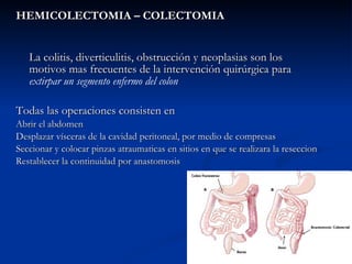 HEMICOLECTOMIA – COLECTOMIA La colitis, diverticulitis, obstrucción y neoplasias son los motivos mas frecuentes de la intervención quirúrgica para  extirpar un segmento enfermo del colon Todas las operaciones consisten en  Abrir el abdomen Desplazar vísceras de la cavidad peritoneal, por medio de compresas Seccionar y colocar pinzas atraumaticas en sitios en que se realizara la reseccion Restablecer la continuidad por anastomosis 