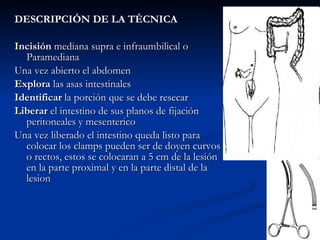 DESCRIPCIÓN DE LA TÉCNICA Incisión  mediana supra e infraumbilical o Paramediana Una vez abierto el abdomen Explora  las asas intestinales Identificar  la porción que se debe resecar Liberar  el intestino de sus planos de fijación peritoneales y mesenterico Una vez liberado el intestino queda listo para colocar los clamps pueden ser de doyen curvos o rectos, estos se colocaran a 5 cm de la lesión en la parte proximal y en la parte distal de la lesion 