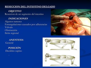 RESECCION DEL INTESTINO DELGADO OBJETIVO Reseccion de un segmento del intestino INDICACIONES Algunos tumores Estrangulaciones causados por adherencias Vólvulo Obstrucción  Ileitis regional   ANESTESIA General POSICIÓN Decúbito supino · 