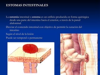 ESTOMAS INTESTINALES La  ostomia  intestinal o  estoma  es un orificio producida en forma quirúrgica desde una parte del intestino hacia el exterior, a través de la pared abdominal Desviar el contenido intestinal con objetivo de permitir la curación del intestino Según el nivel de la lesión Puede ser temporal o permanente  