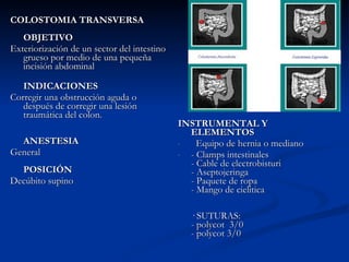 COLOSTOMIA TRANSVERSA OBJETIVO Exteriorización de un sector del intestino grueso por medio de una pequeña incisión abdominal INDICACIONES Corregir una obstrucción aguda o después de corregir una lesión traumática del colon. ANESTESIA General POSICIÓN Decúbito supino INSTRUMENTAL Y ELEMENTOS Equipo de hernia o mediano - Clamps intestinales - Cable de electrobisturi - Aseptojeringa - Paquete de ropa - Mango de cielitica · SUTURAS: - polycot  3/0  - polycot 3/0  