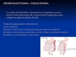 <ul><li>HEMICOLECTOMIA – COLECTOMIA </li></ul><ul><li>La colitis, diverticulitis, obstrucción y neoplasias son los motivos...