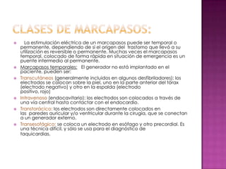      La estimulación eléctrica de un marcapasos puede ser temporal o
    permanente, dependiendo de si el origen del trastorno que llevó a su
    utilización es reversible o permanente. Muchas veces el marcapasos
    temporal, colocado de forma rápida en situación de emergencia es un
    puente intermedio al permanente.
   Marcapasos temporales: El generador no está implantado en el
    paciente, pueden ser:
   Transcutáneos (generalmente incluidos en algunos desfibriladores): los
    electrodos se colocan sobre la piel, uno en la parte anterior del tórax
    (electrodo negativo) y otro en la espalda (electrodo
    positivo, rojo)
   Intravenoso (endocavitario): los electrodos son colocados a través de
    una vía central hasta contactar con el endocardio.
   Transtorácico: los electrodos son directamente colocados en
    las paredes auricular y/o ventricular durante la cirugía, que se conectan
    a un generador externo.
   Transesofágico: se coloca un electrodo en esófago y otro precordial. Es
    una técnica difícil, y sólo se usa para el diagnóstico de
    taquicardias.
 