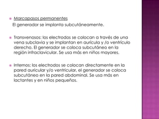    Marcapasos permanentes
    El generador se implanta subcutáneamente.


   Transvenosos: los electrodos se colocan a través de una
    vena subclavia y se implantan en aurícula y /o ventrículo
    derecho. El generador se coloca subcutáneo en la
    región infraclavicular. Se usa más en niños mayores.


   Internos: los electrodos se colocan directamente en la
    pared auricular y/o ventricular, el generador se coloca
    subcutáneo en la pared abdominal. Se usa más en
    lactantes y en niños pequeños.
 