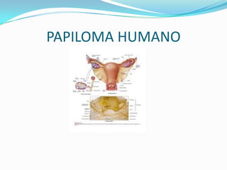 PAPILOMA HUMANO