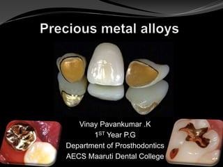 Vinay Pavankumar .K
1ST Year P.G
Department of Prosthodontics
AECS Maaruti Dental College
 