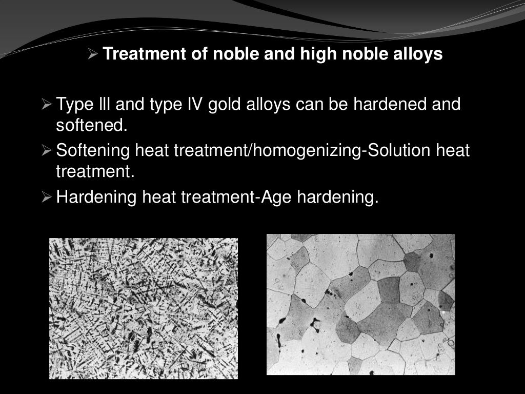 Precious metal alloys in dentistry