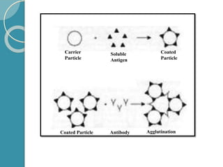 Carrier
Particle
Soluble
Antigen
Coated
Particle
Coated Particle Antibody Agglutination
 