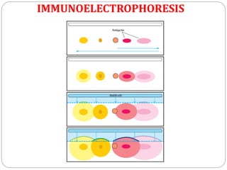 IMMUNOELECTROPHORESIS
 