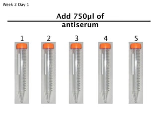 Week 2 Day 1


                   Add 750µl of
                    antiserum
       1       2       3      4   5
 