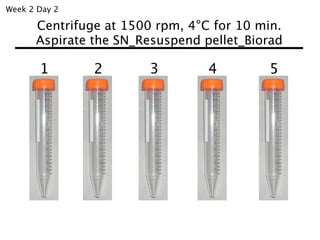Week 2 Day 2

      Centrifuge at 1500 rpm, 4°C for 10 min.
      Aspirate the SN_Resuspend pellet_Biorad

       1       2        3        4        5
 