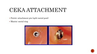 Precision attachment.pptx
