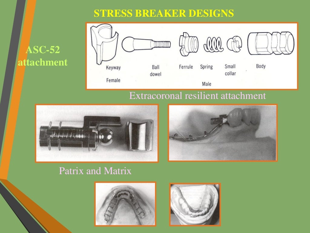 Precision attachments
