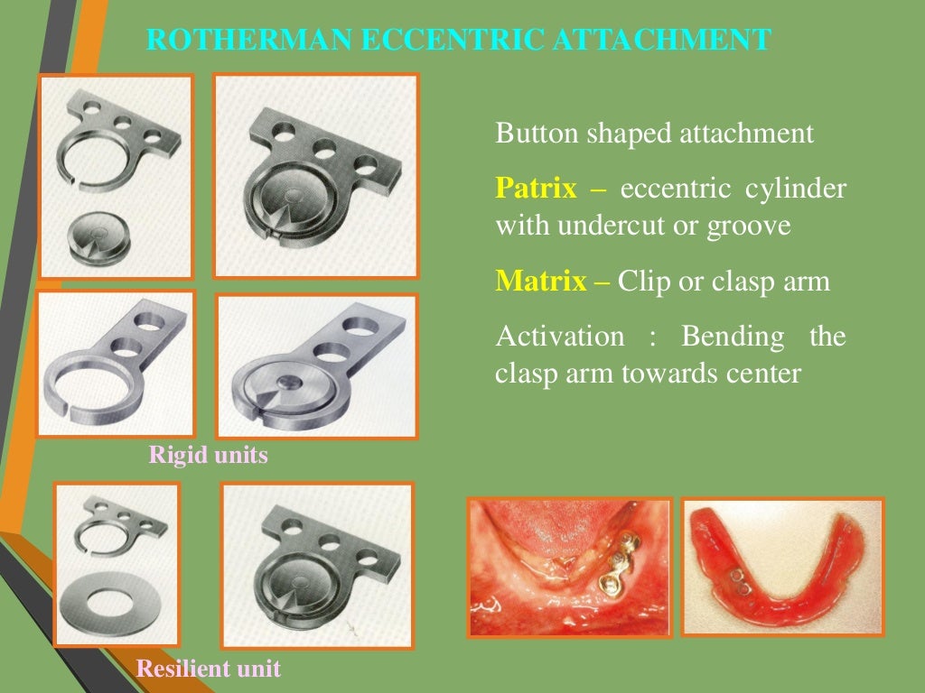 Precision attachments