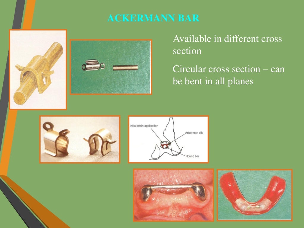 Precision attachments